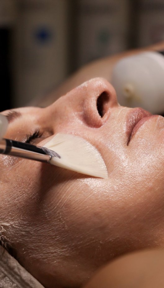 Application d'un peeling sur le visage